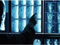 科技进步奖获得者许开元博士,分享医学影像研究成果