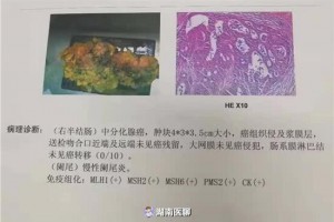怎么补也补不上来的贫血，原来与癌细胞有关，出现这些症状要警惕