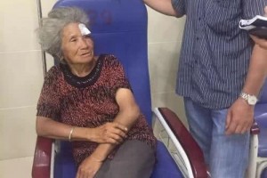 辟谣：吃酱油会让疤痕颜色变深？今天告诉你为什么会留下黑印子