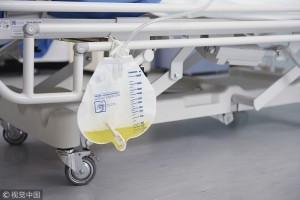 出现这4种异常说明肾病已经恶化求你别再拖了