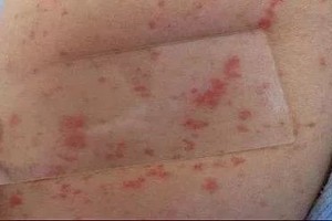 70%的妈妈都没注意到床上的这个细节直接影响孩子的健康……