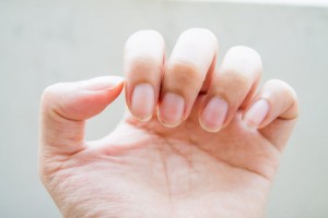 不管男女指甲呈现3种颜色改变当心肿瘤已埋伏