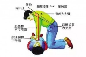 学会心肺复苏术关键时刻你能救命