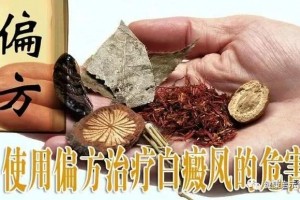 还再四处寻找银屑病偏方你一定不知道这些偏方的危害