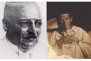医阶科普脑海中的橡皮擦——阿尔茨海默病