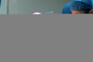 隆鼻术中有哪些切口类型各有哪些优点