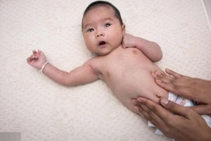 小儿出现腹股沟疝的几率大吗此病不好预防严重的还会肠坏死