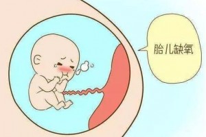 胎儿宫内缺氧的前兆有哪些如何预防及治疗宫内缺氧