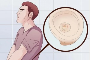 尿血的3个原因已找到第1个不用担心若是第3个尽快看医生