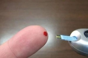 肠道菌群经过血清素负面影响机体血糖水平