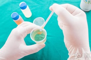 体检陈述上哪个成果最重要体检首要项目目标解读有用