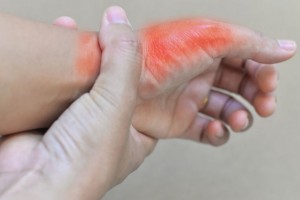 除了三高还有尿酸高面临这4高饮食恪守3多3少很难升高