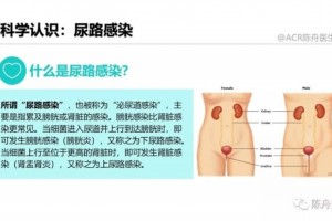 尿路感染的医治和防备