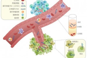 抽血测基因查癌症听起来挺简略的……