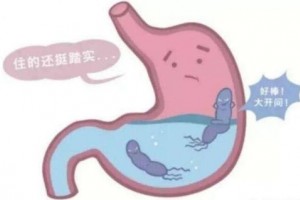幽门螺旋杆菌感染的危害性试试它的克星