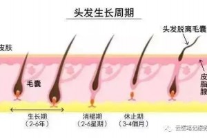 男人掉发很常见女性掉发更恐惧