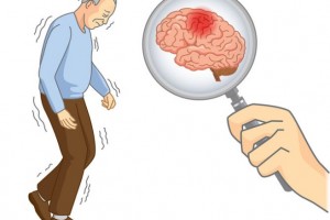 睡觉时若呈现4种体现或是脑梗来报导的先兆别忽视