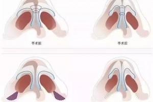 女神未满恐怕是你的鼻尖不行美丽吧