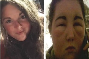 可怕英国女子染发后大变脸从此见不得太阳