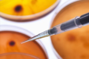 每10人中就有一人患有糖尿病干细胞技能能做些什么