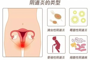 女人乳头发黑是怎么回事多少女人被它的污名摧残