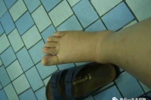 这样被逼着去死的白叟有许多或许未来有一个便是我和你