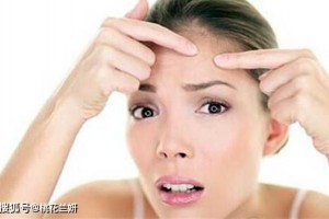 粉刺和硫磺皂间不可不说的事