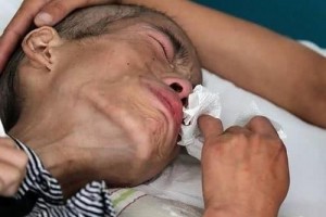 喝白酒红酒和啤酒究竟哪种酒最伤肝真实伤肝的是一种酒