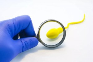 5个判别精子质量的规范请男人们自检一下