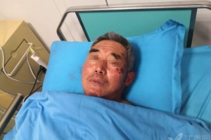 吃药后昏倒2小时全身酸痛的男人丁香病例