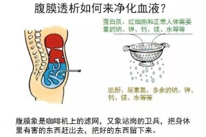 【话说透析】腹透了我该怎么日子