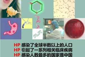 2种汤是幽门螺旋杆菌的天敌高效防备胃癌医师共享这3招