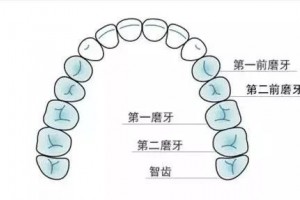 不想拔牙或许你可以直接进行磨牙远移