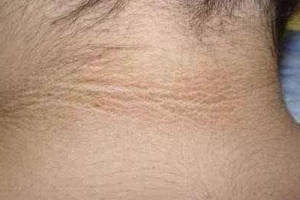 身体上不应该呈现的四道印儿若你都没有阐明身体还算健康