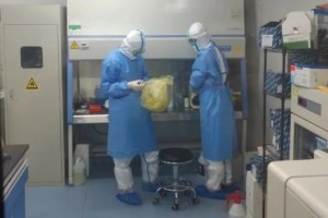 新发现痰液病毒载量更能反映体内病毒仿制水平
