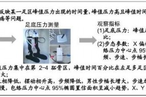 晚年糖尿病患者的足底压力及步态特征