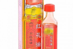 扭伤后千万别乱动这样做好得更快