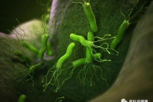 感染了幽门螺杆菌怎么办——Hp感染规范处理流程