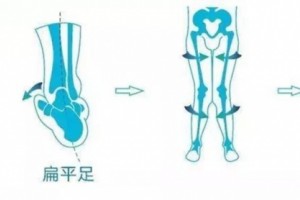 英中耐（重庆）假肢矫形器,让肢体残疾人“站起来”！