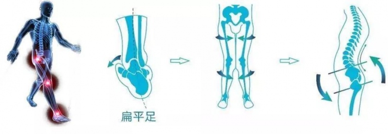 英中耐(重庆)假肢矫形器,让肢体残疾人“站起来”!