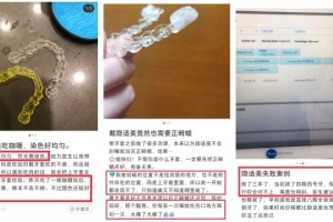 扒一扒为什么隐适美更有名,但大多数人做牙齿矫正还是选择时代天使？