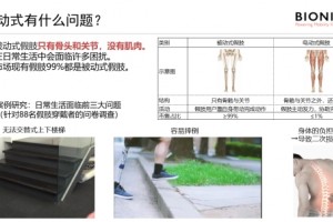 智能电动假肢，肢者一生“肢”友——冥冥中邂逅的健行仿生